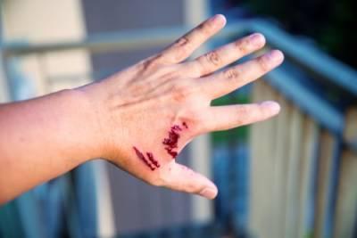 Naperville dog bite injury attorneys